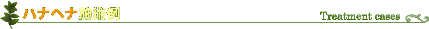 ハナヘナ施術例